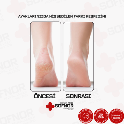 SOFNOR PRO 3 | AYAK PEDİKÜR CİHAZI – Pürüzsüz Ayaklar İçin
